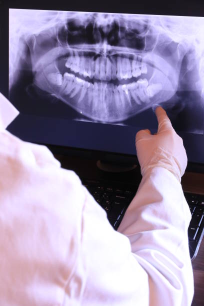Best Emergency Dental Care for Broken or Chipped Teeth in Dogtown, CA